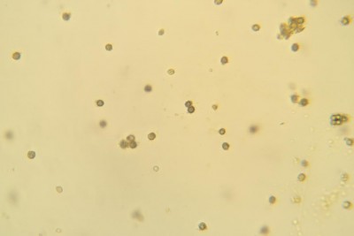 rz spore amiloidi-Lactarius sp..jpg