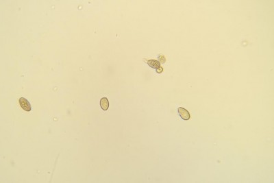 rz spore con poro germinativo-Macrolepiota procera-.jpg