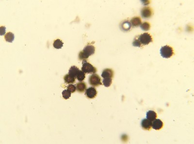 rz spore echinulate-Scleroderma-sp.jpg