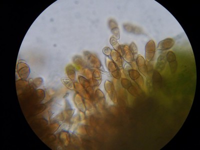 Puccinia malvacearum -  teliospore.JPG