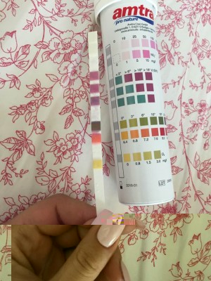 14441099_10208989468526150_569240589107000366_n.jpg (85.8 KiB) Osservato 2241 volte 14441099_10208989468526150_569240589107000366_n.jpg