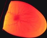 speratura.jpg speratura.jpg