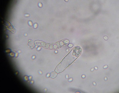 taphrina pruni 1.JPG (80.73 KiB) Osservato 629 volte taphrina pruni 1.JPG