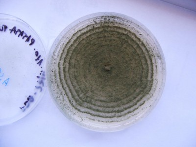 aspergillus sp..JPG (71.36 KiB) Osservato 997 volte aspergillus sp..JPG