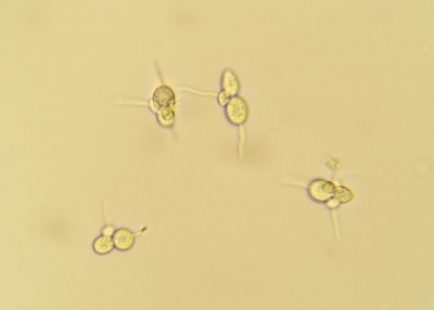 Entomosporium-mespili--nespolo-giap.jpg