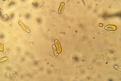 resize melo conidia (Colletrotrichum sp).jpg (52.96 KiB) Osservato 937 volte resize melo conidia (Colletrotrichum sp).jpg