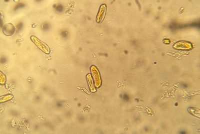 resize melo conidia (Colletrotrichum sp).jpg