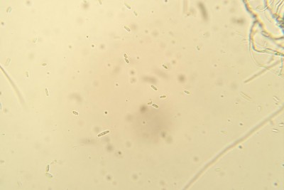 Fusarium sp. microconidi.jpg