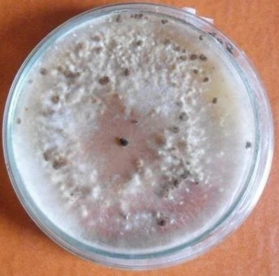Sclerotia-of-Rhizoctonia-solani.jpg