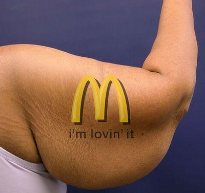 McFat-arm.jpg McFat-arm.jpg