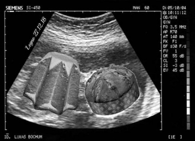 Natale 4.jpg (34.74 KiB) Osservato 693 volte Natale 4.jpg