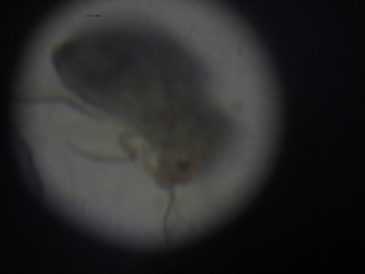 Salve sono nuovo del forum, ogni tanto sul banco di lavoro vedo camminare dei piccoli ragnetti, quasi non visibili ad occhio nudo, solo se ti avvicini riesci a vederli perchè sono piccoli la metà di mezzo millimetro, volevo sapere che tipo di parassita è, ho fatto delle foto al microscopiotelescopio con ingrandimento a 20x. Grazie aspetto una vostra risposta. / 800IMG_2958.jpg 800IMG_2958.jpg