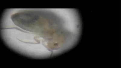 Salve sono nuovo del forum, ogni tanto sul banco di lavoro vedo camminare dei piccoli ragnetti, quasi non visibili ad occhio nudo, solo se ti avvicini riesci a vederli perchè sono piccoli la metà di mezzo millimetro, volevo sapere che tipo di parassita è, ho fatto delle foto al microscopiotelescopio con ingrandimento a 20x. Grazie aspetto una vostra risposta. / parassita.mp40151.jpg parassita.mp40151.jpg