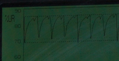 Variazione.jpg (36.86 KiB) Osservato 17985 volte Variazione.jpg