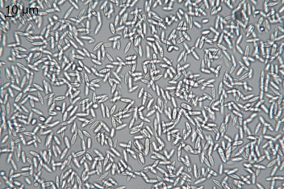 Forzaspal -COLLETOTRICHUM_olivo_frutto_conidi_16x4-micron.JPG (154.3 KiB) Osservato 668 volte Forzaspal -COLLETOTRICHUM_olivo_frutto_conidi_16x4-micron.JPG