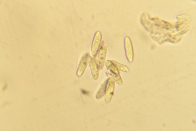 Bordighera -marciume oliva - conidia (B. dothidea).jpg