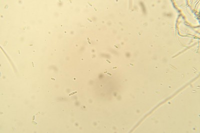 Fusarium sp. microconidi.jpg