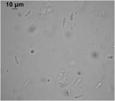 ticchiolatura rosa conidi.png (202.59 KiB) Osservato 683 volte ticchiolatura rosa conidi.png