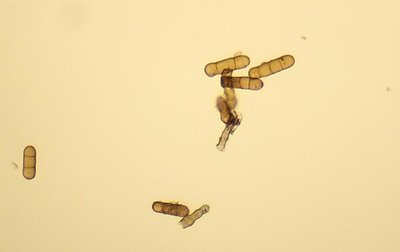 rz-Mycosphaerella-macrospora-iris-conidi-2.jpg