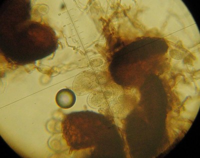 cleistotecio-aschi-erysiphe.jpg (103.8 KiB) Osservato 840 volte cleistotecio-aschi-erysiphe.jpg