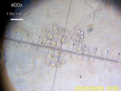 Vite-peronospora-sporangi.jpg (232.98 KiB) Osservato 559 volte Vite-peronospora-sporangi.jpg