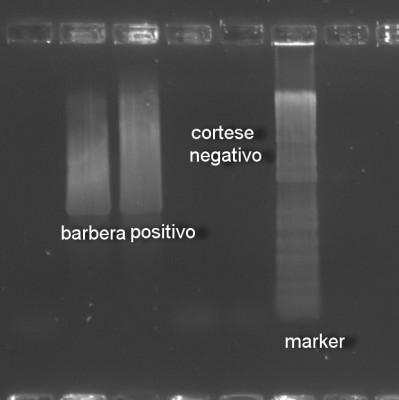 9-FD - elettroforesi PCR.jpg