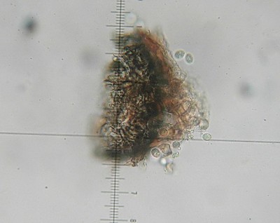 black rot picnidio-conidi-.JPG (95.41 KiB) Osservato 987 volte black rot picnidio-conidi-.JPG